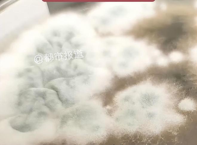 手术中面罩意外砸眼 患者复查发现右眼眼球有线头残留